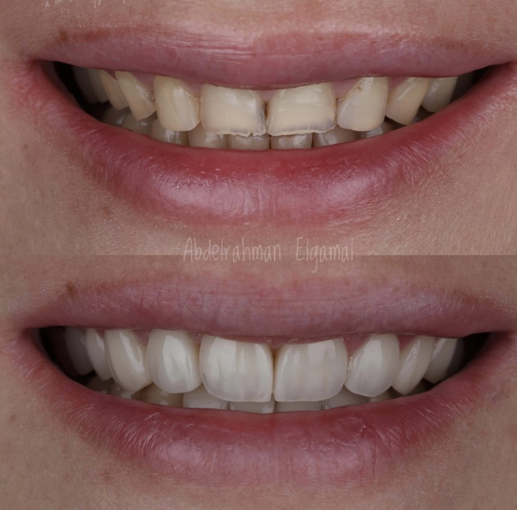 1556A1E0-3B8B-41A2-B99C-6EA983D25EB8