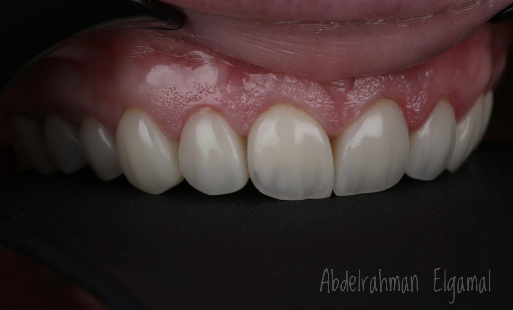 1B48F108-5CDB-4AD9-9801-6479B399CD32