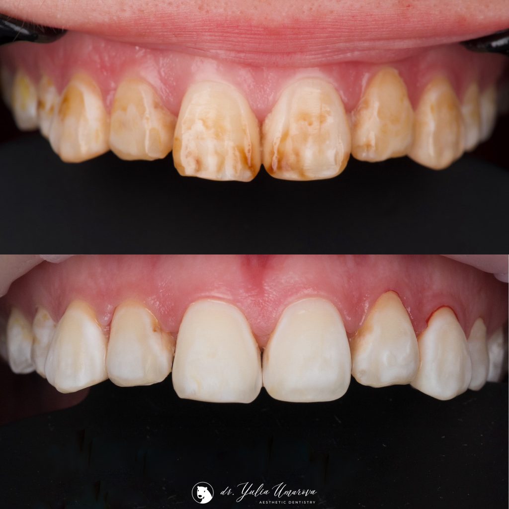 1BD07D47-3A4B-4574-9B86-678130A2642E