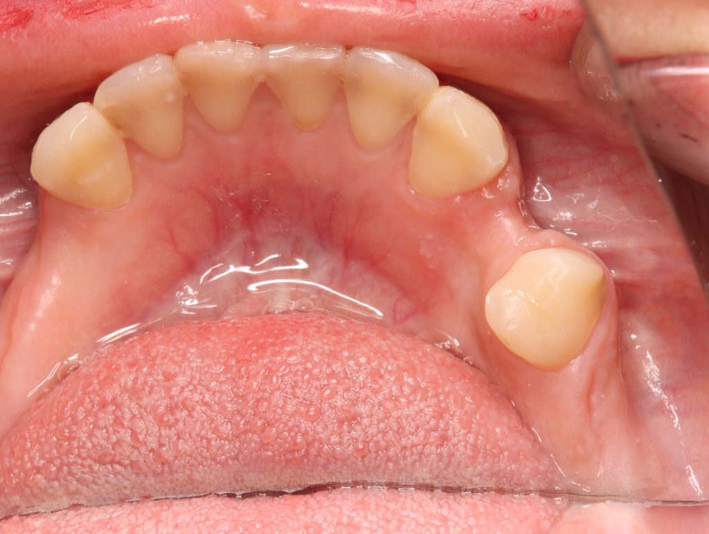 20240110195833_IMG_8011