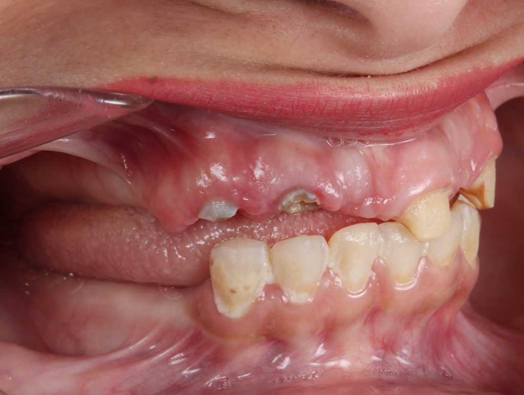 20240110200017_IMG_8017