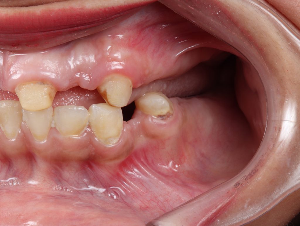 20240110200030_IMG_8019