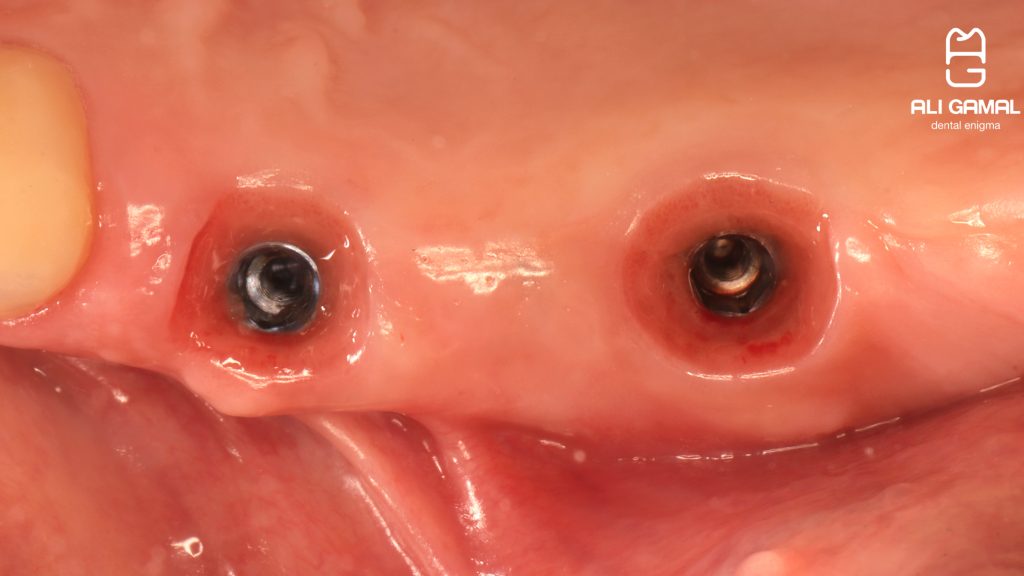 20240710204151_IMG_9102