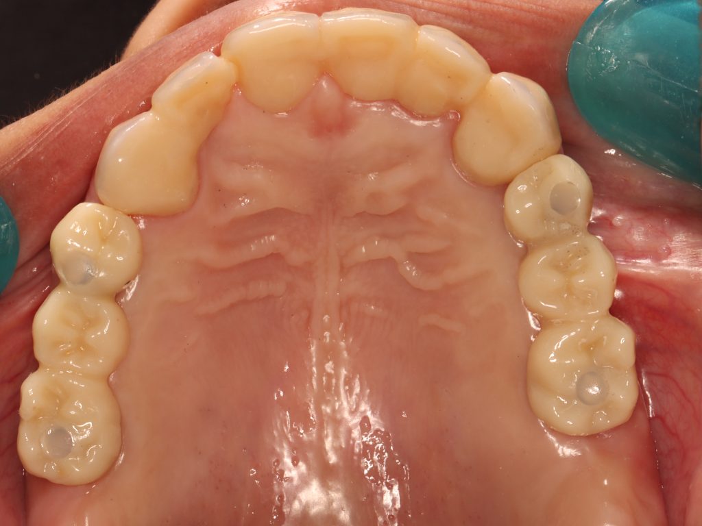 20240728184136_IMG_9228