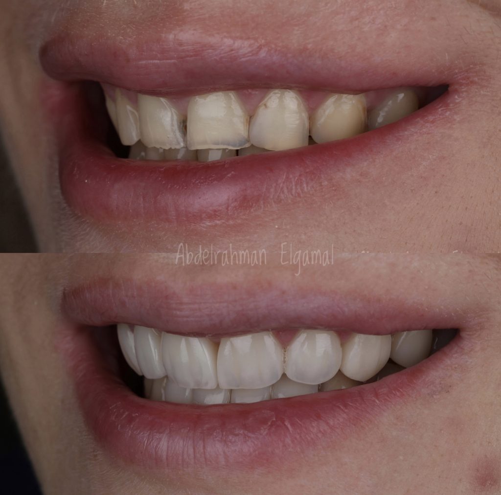 20A8CC3F-F623-450F-BEA6-62E728DB8A88