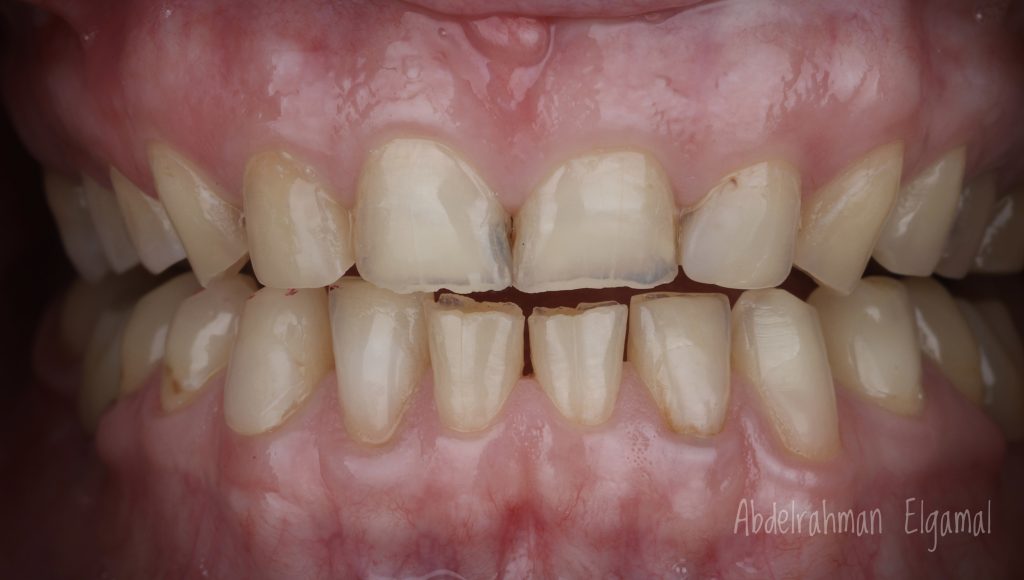 20BD3D18-ACB9-48AC-B16D-D8509A2C6DBA