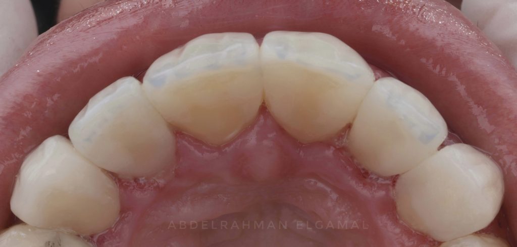 22751665-77AD-4378-A95D-83279E02D6DB