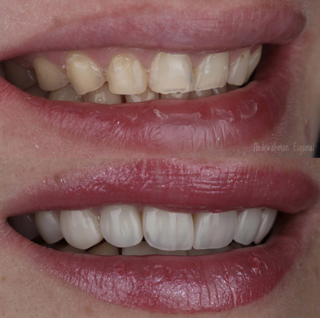 26F16808-F09E-4EF1-8692-0A88E18C8DC1