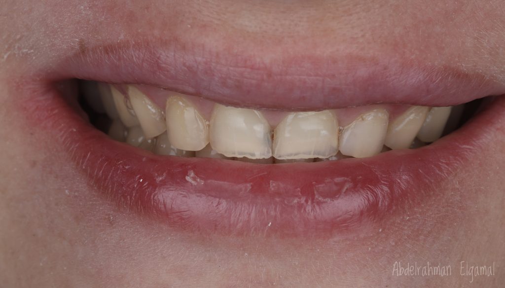 2AD29AEE-6CE7-4546-BDAE-F39CA6A0CA8F