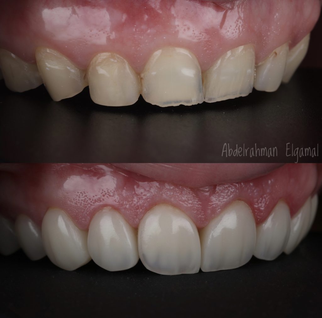 32ADE1B7-09E2-4629-B0FC-9F38E3AFC20C