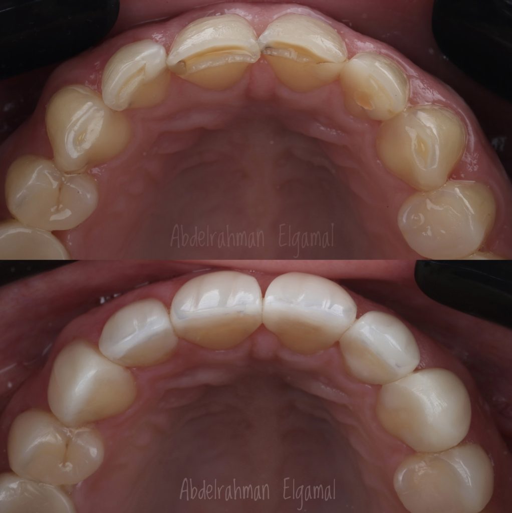 378634AD-444A-471E-ABF7-8FD6F2F495A8