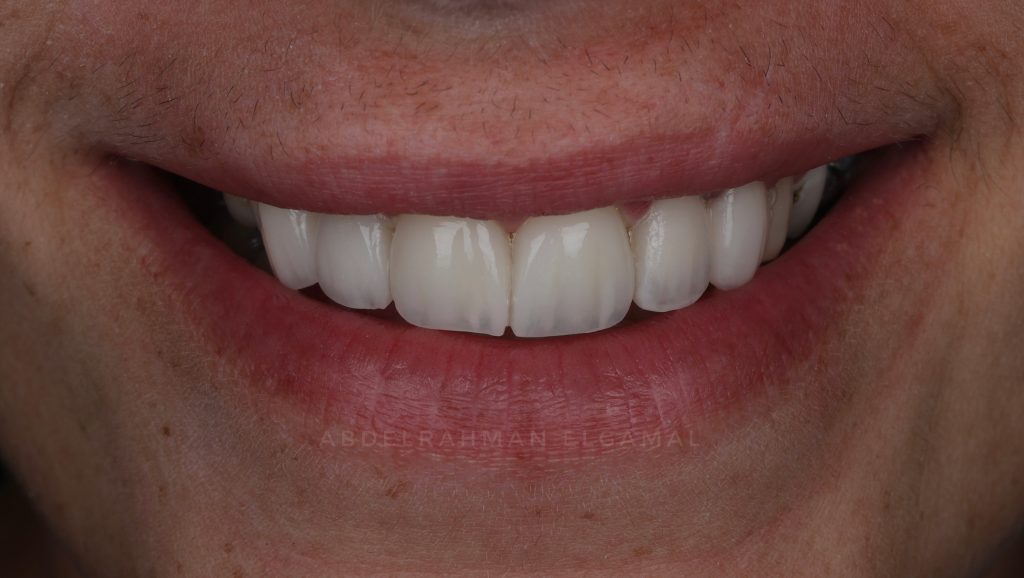 4090D34E-4F39-4B7A-871C-1FB9D3BAA76E