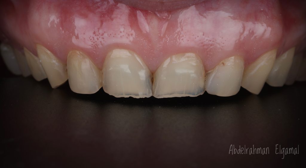 40F7F41F-D760-4C63-9996-09D0DA25BC5F