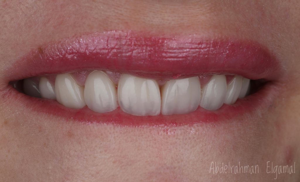 44E3954B-65F8-4ED9-AD68-3FE384AD7991