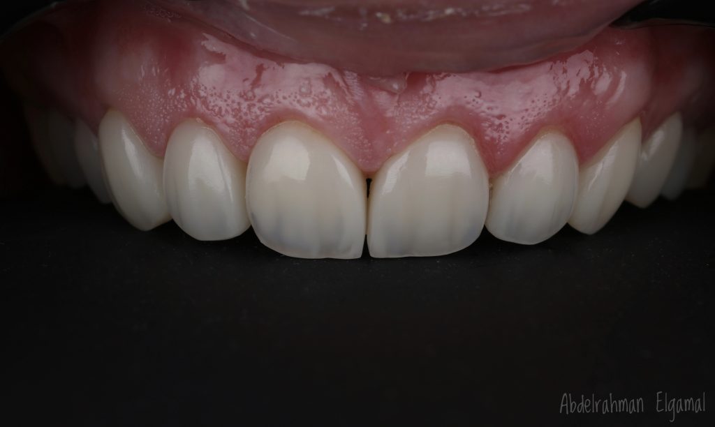 47050663-D4CC-45D9-9F44-F620465A344A