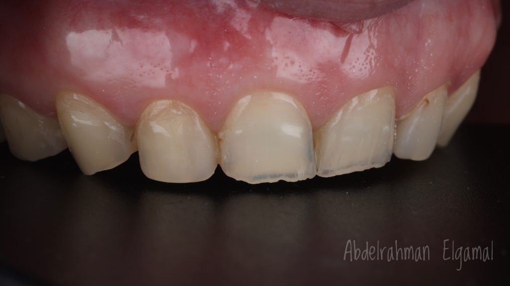 55786F66-BE06-4DD3-8F0C-C983BA06F227