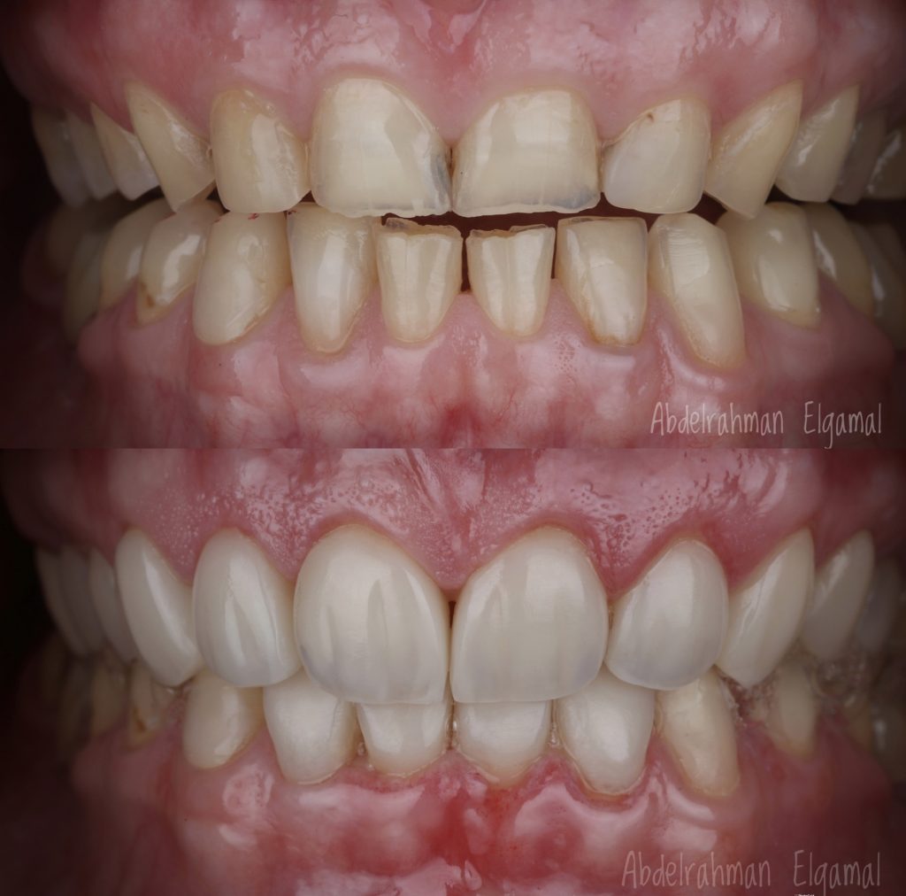 5CE0142C-6954-46EB-B5F6-BDFE2CA86F60