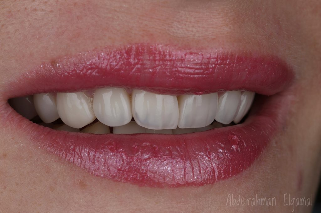 5DBE7EA3-543D-4813-AECB-E410B336A9AD