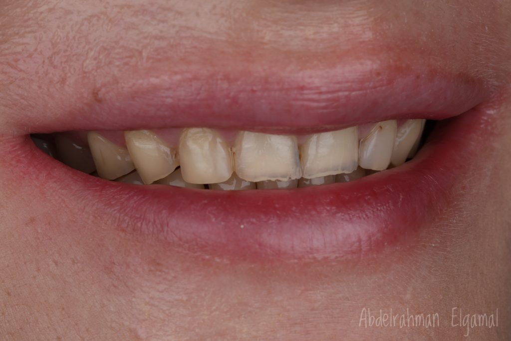 6102ECD1-1D83-4A73-BF8F-5FEF65AAB093