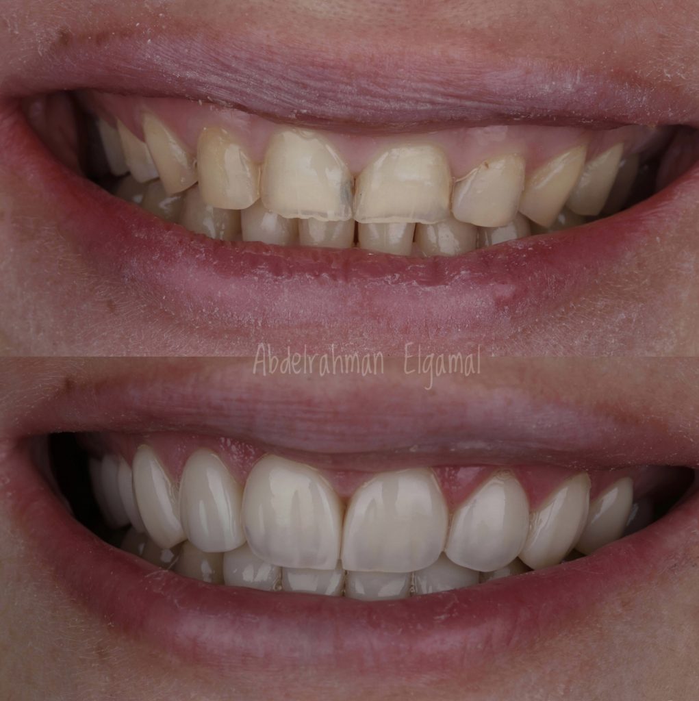 64661C93-AAFD-4FB9-B31A-AF73E256FD70