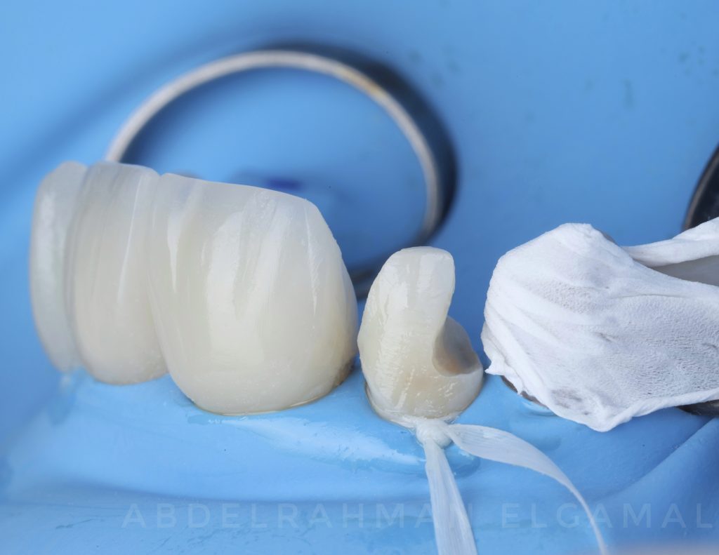 66C0D3CD-434E-4D54-8D93-FD77A8476BE0