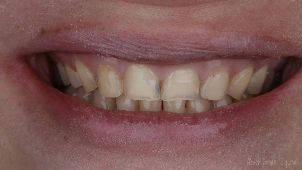 6E20DEE7-3649-48EF-B4D0-AD77D9B8375D