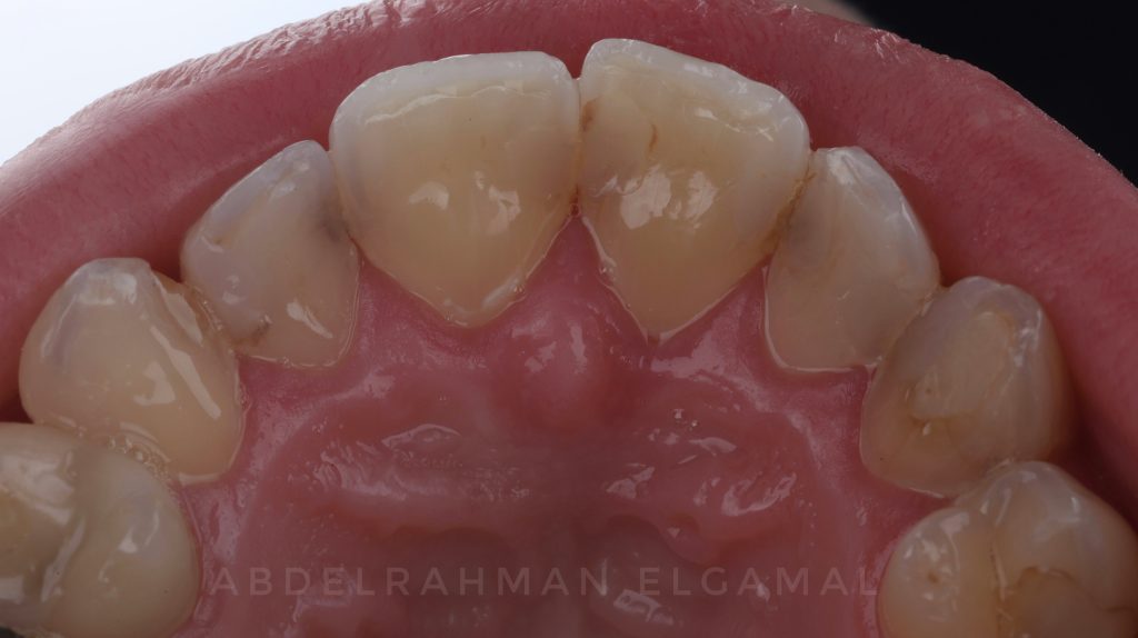 74BB396E-D684-436A-8CFD-157A747046CB