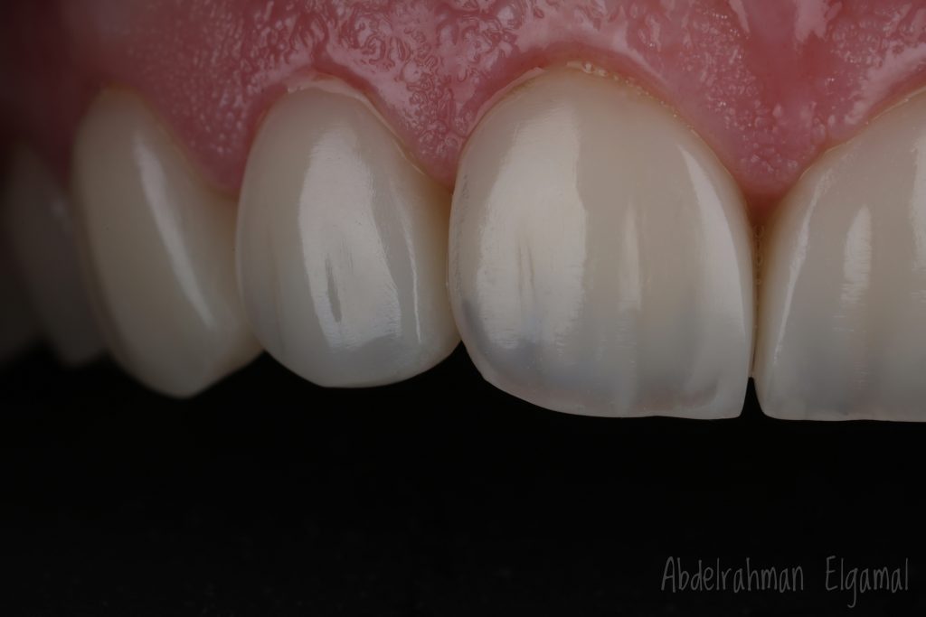 78D3CA40-9BFF-44C9-AB91-96C17E49A4C6