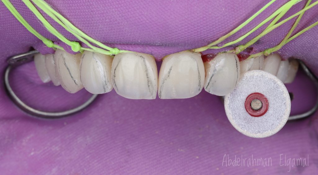 7A128D90-0D9D-4787-B64E-AEC8A4CACFFD