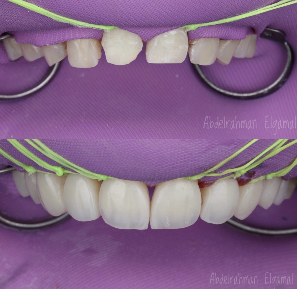 7D2918E2-E550-45F9-A3A8-F7585A92348D