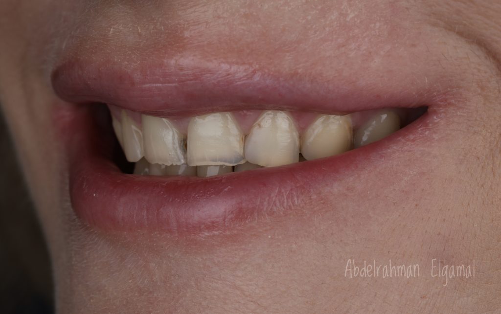 82E39835-F100-40DF-A490-8287FC689382