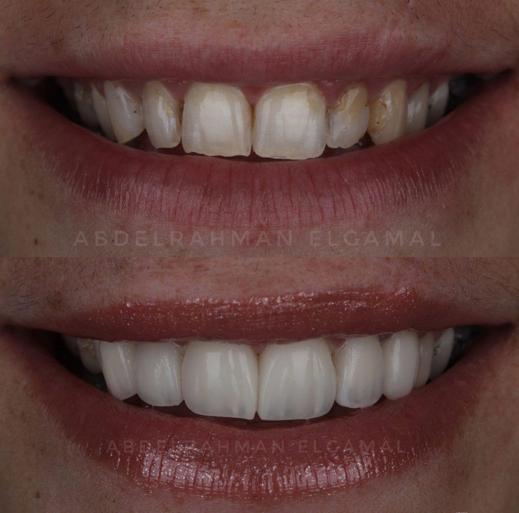 85789D35-3FB4-4A35-A583-62653DAD77A5