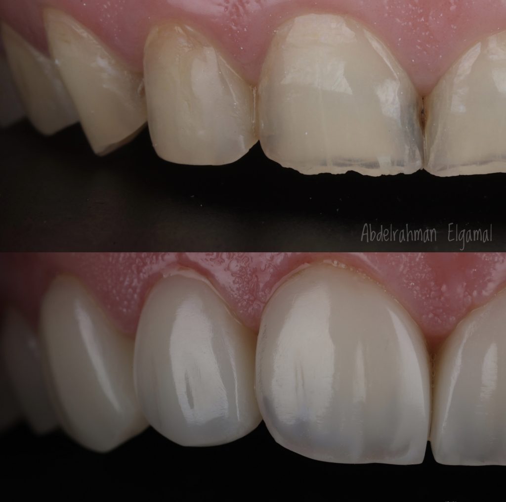 92975B81-BED8-4013-A451-3C9ECF9F508E