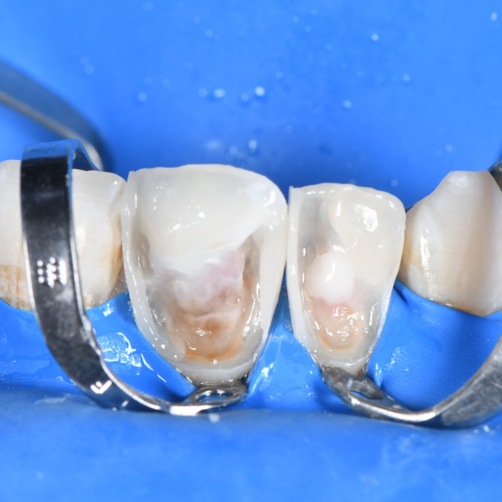 93A2CF86-CAED-4A3E-8570-B965C58C75EB