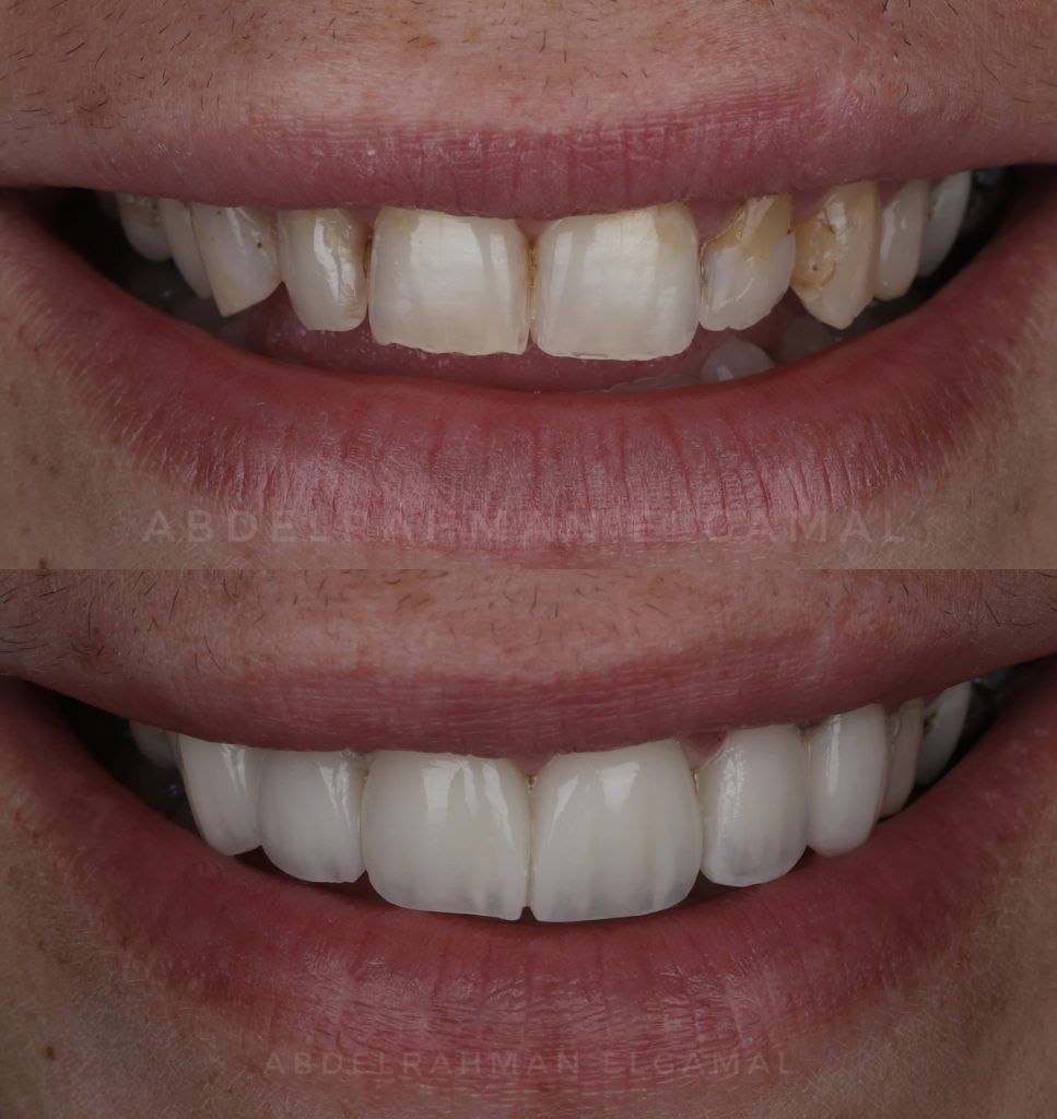 99AAE9F5-EAAB-4CE6-93DC-8C164AC1E49C