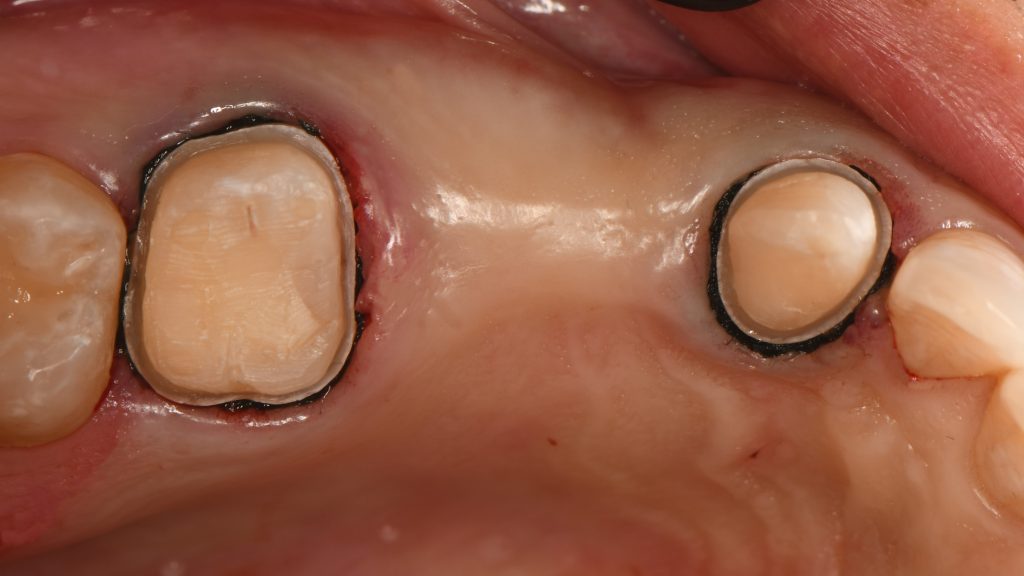 9A204F65-944C-4846-8BA9-CB9A635C0B15