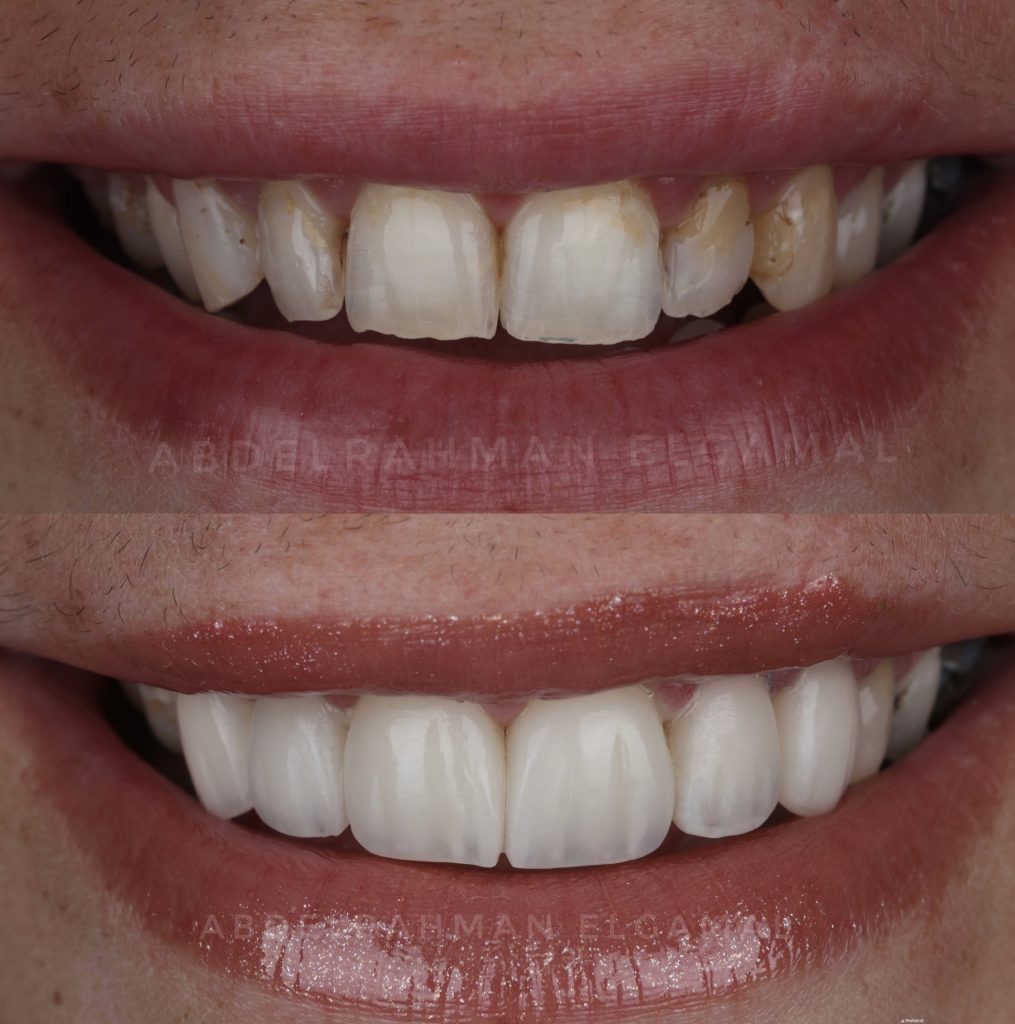 A26C4370-A959-4220-BB1E-CE347CDBA67F