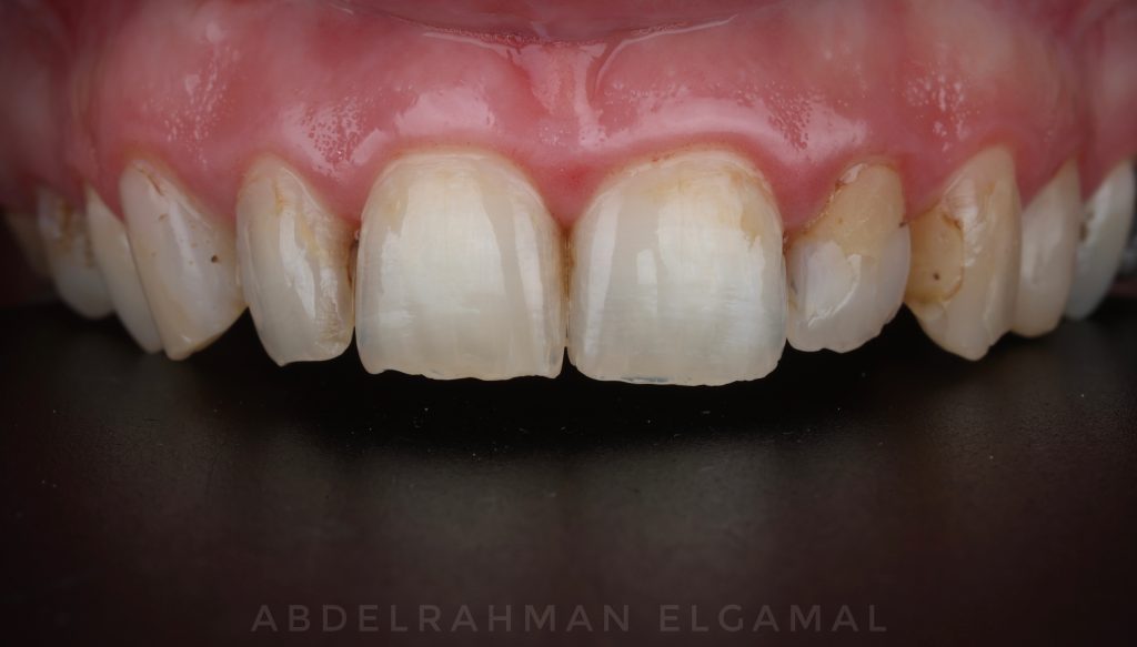 A5EBD0AE-161F-426A-A279-A89FEAE08BCF