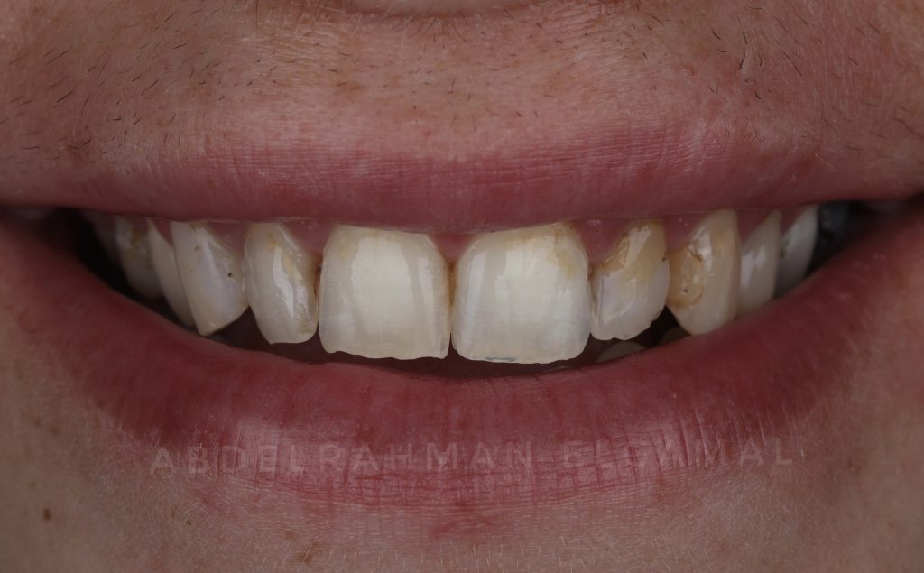 A630B90D-961E-40B4-89E1-7FF36F941F0D