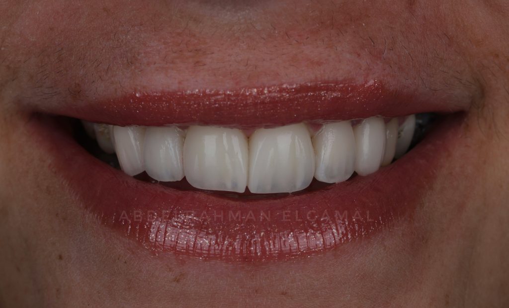 A713285B-61FC-4F60-B891-2D04E83E9E26