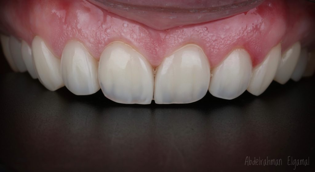 A7CF206E-20DD-4CFB-995C-337CA654780D