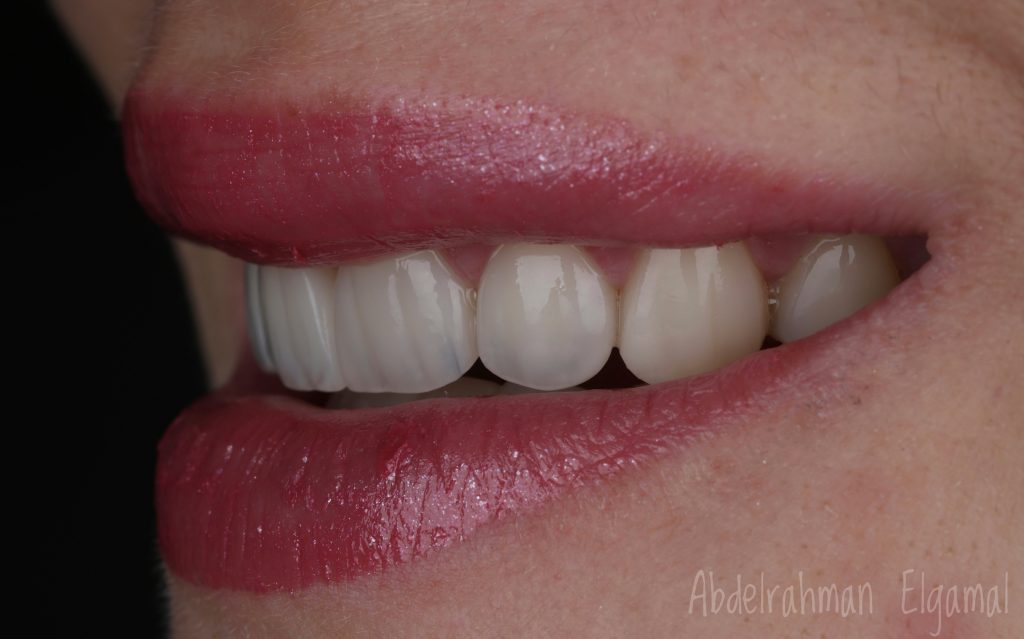 ACD9529E-5597-42E7-957B-AD6ACB894617