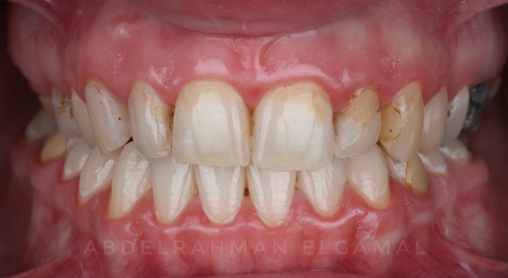 AD5704BF-AFA7-419A-8799-31D050C845E3