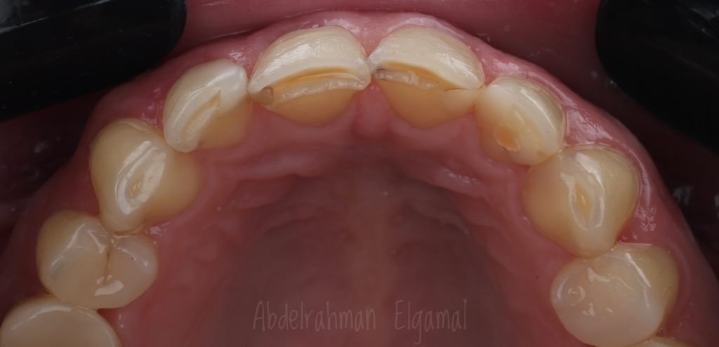 B8BAFAAF-3F5A-4161-ADB9-5FE3B6B81FD0