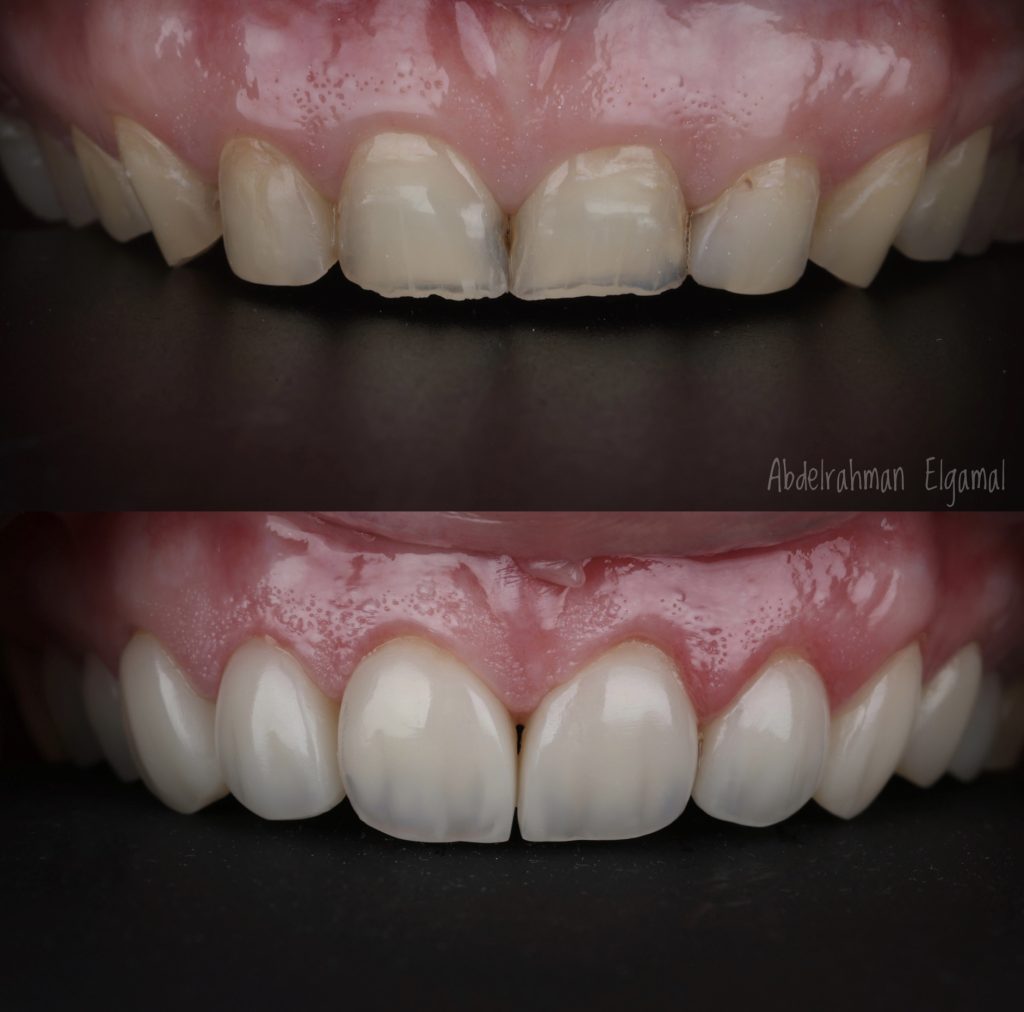 B8E08FD9-C507-4188-806C-5F90D41A1EDC