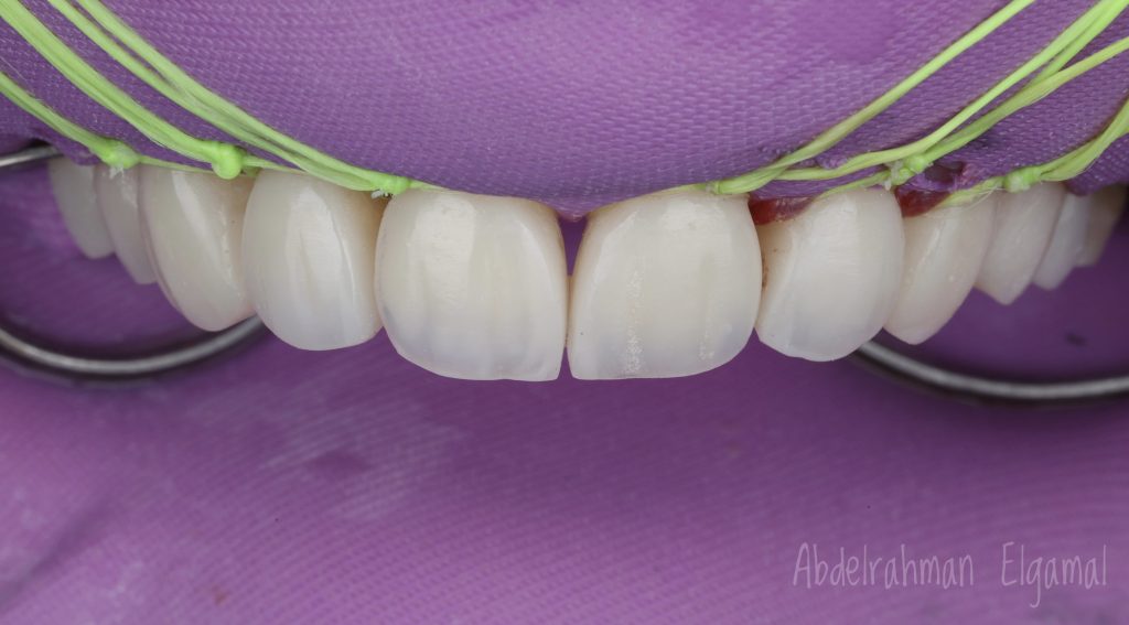 BBA5B0A9-E38A-4B6A-8793-4AD09783F929