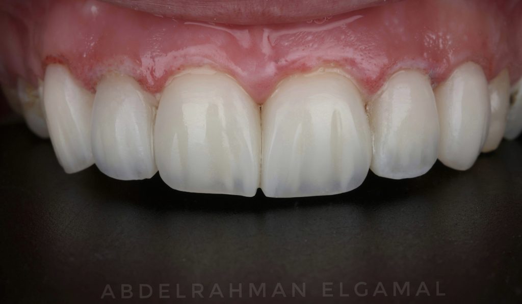 C1AA8C97-4709-4CF4-921A-5BED722F6FC2