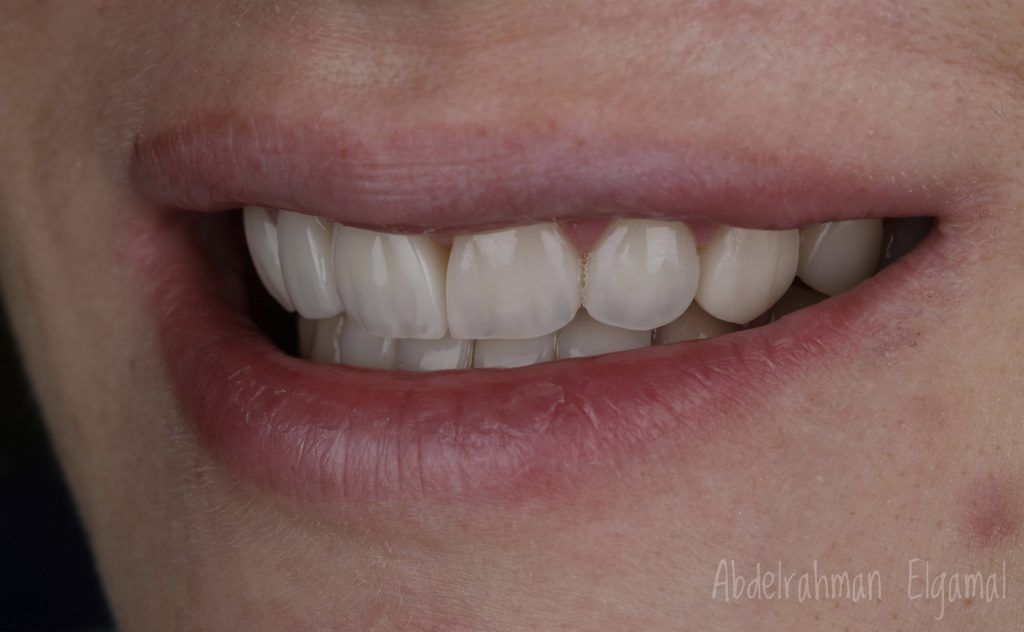 C1E4B26C-A691-4CA2-AA8D-185E25F0B20E