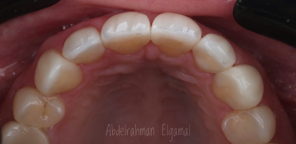 CE8328E1-C2E7-4F1E-A14D-A815B98C9109