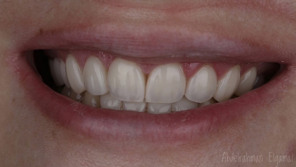 CF17417C-1317-4742-A207-EBDE62928021